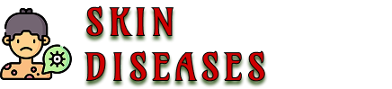 skindiseases.su
